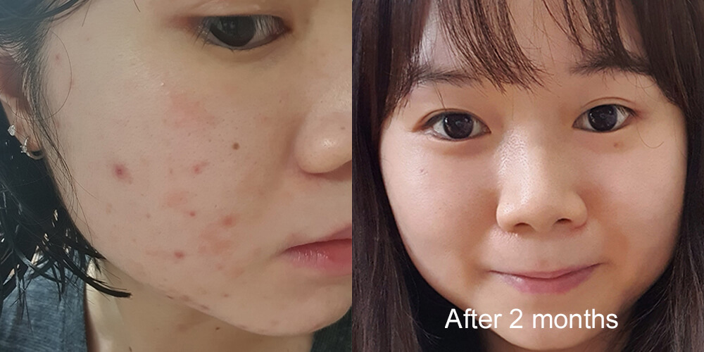 Skinlycious result 01