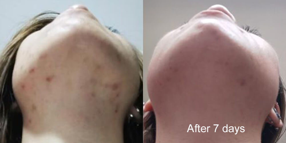 Skinlycious result 01