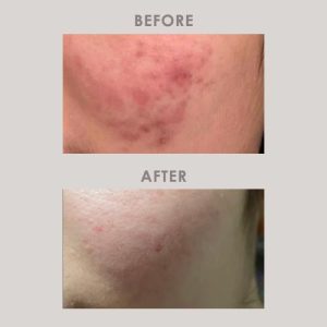 The teenager who keeps breaking out