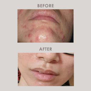 The sensitive breakout